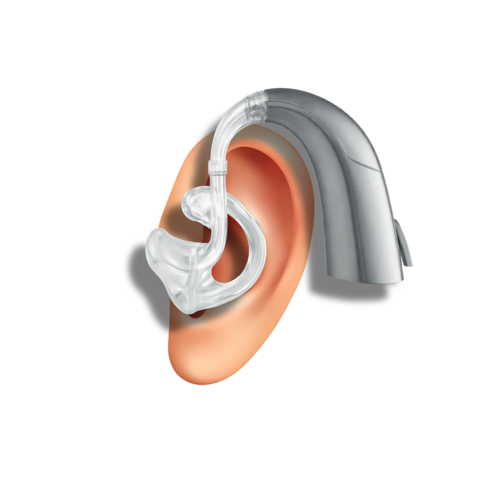 Embouts traditionnels BTE